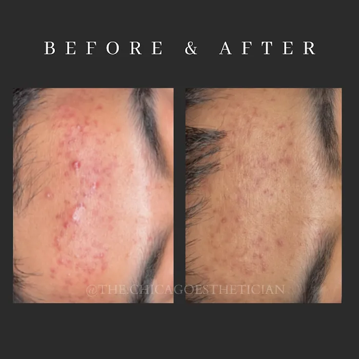 Luminosity Skin Care by The Chicago Esthetician Picture 6