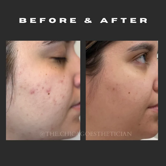 Luminosity Skin Care by The Chicago Esthetician Picture 7