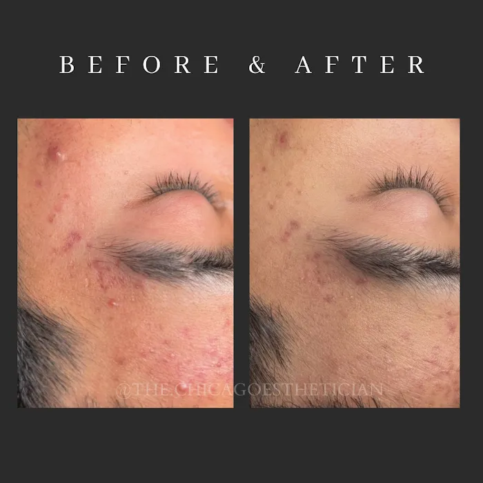 Luminosity Skin Care by The Chicago Esthetician Picture 8