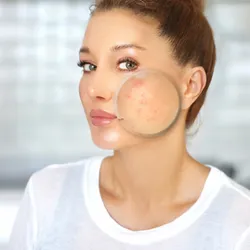 The Derm NP, PLLC Picture 1