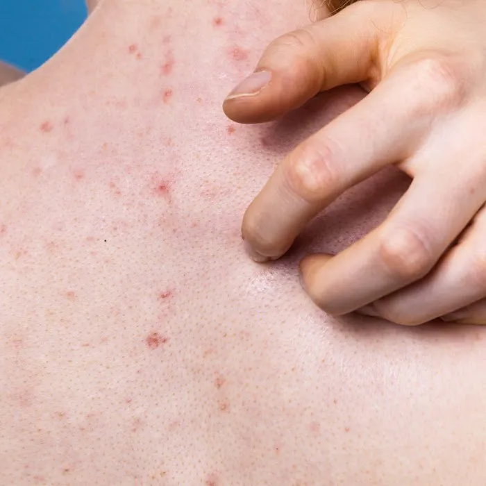 The Derm NP, PLLC Picture 4