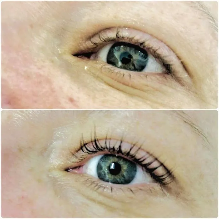 Ana Shpilman Facial Spa & Skin Care Clinic Highland Park Picture 5