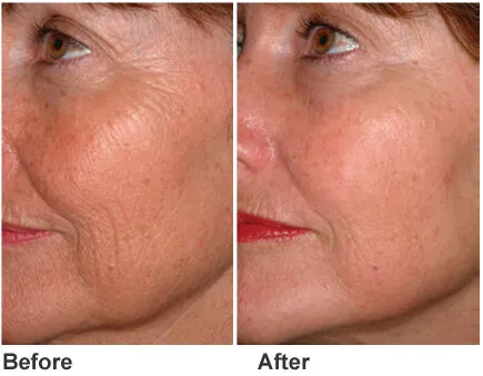 Pure Skin by Agnes Spa Natural remedies Picture 1