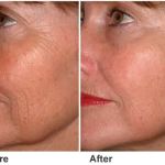 Pure Skin by Agnes Spa Natural remedies