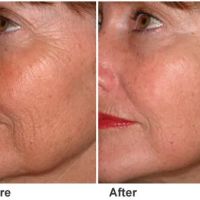 Pure Skin by Agnes Spa Natural remedies ico