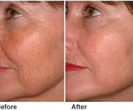 Pure Skin by Agnes Spa Natural remedies