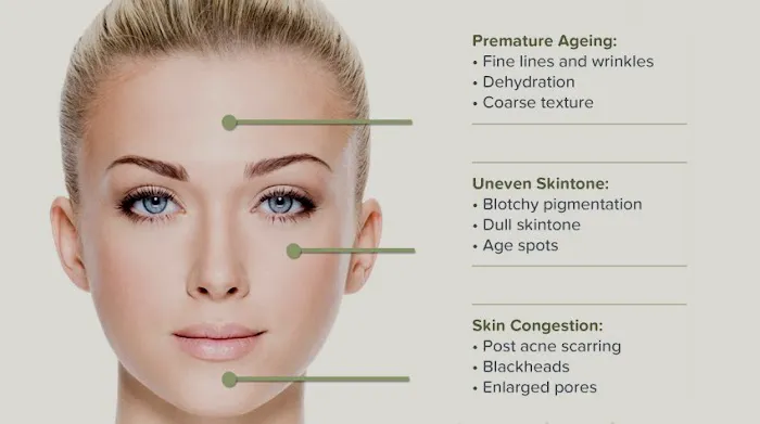 Marila Aesthetics & Wellness | Botox and Dermal Fillers Picture 8