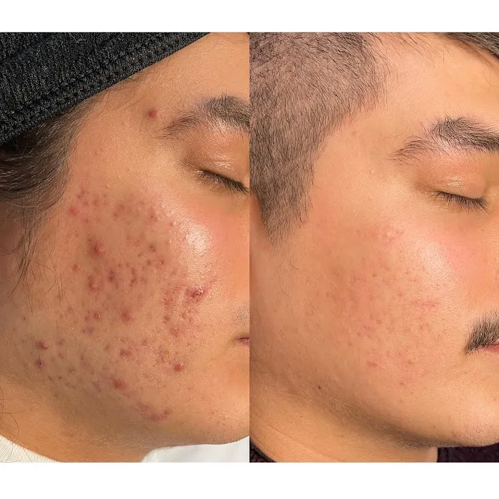 CW Esthetics Picture 2