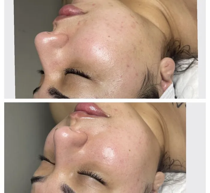 Brightside Aesthetics Picture 4