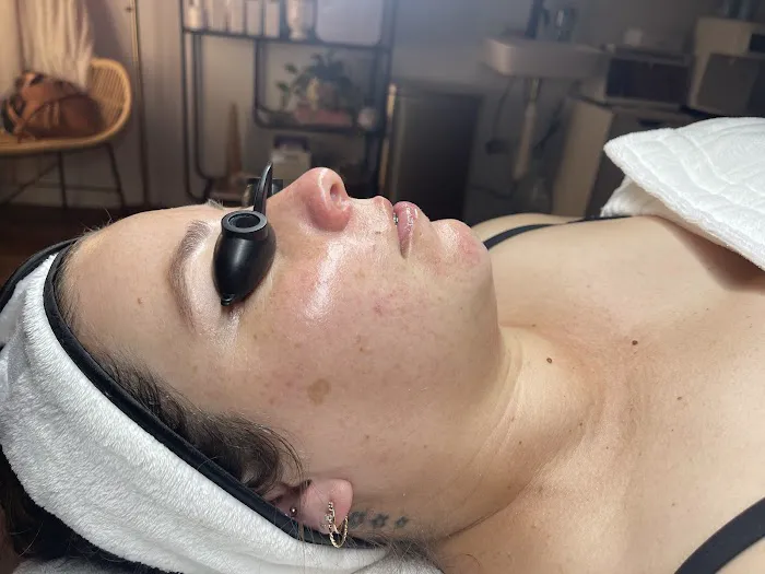 Brightside Aesthetics Picture 5