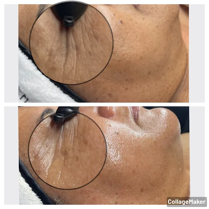 Brightside Aesthetics Picture 9