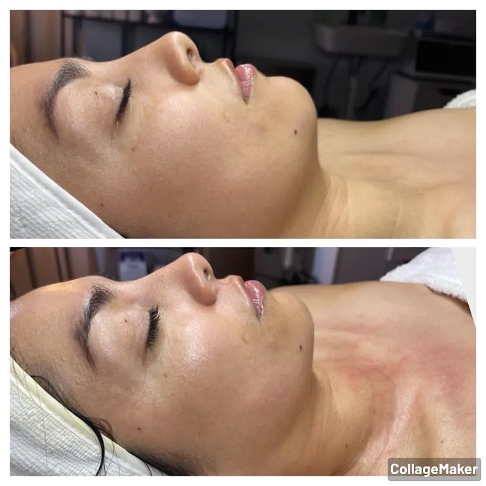 Brightside Aesthetics Picture 6