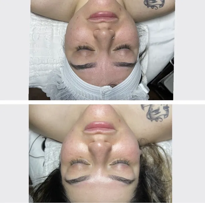 Brightside Aesthetics Picture 7