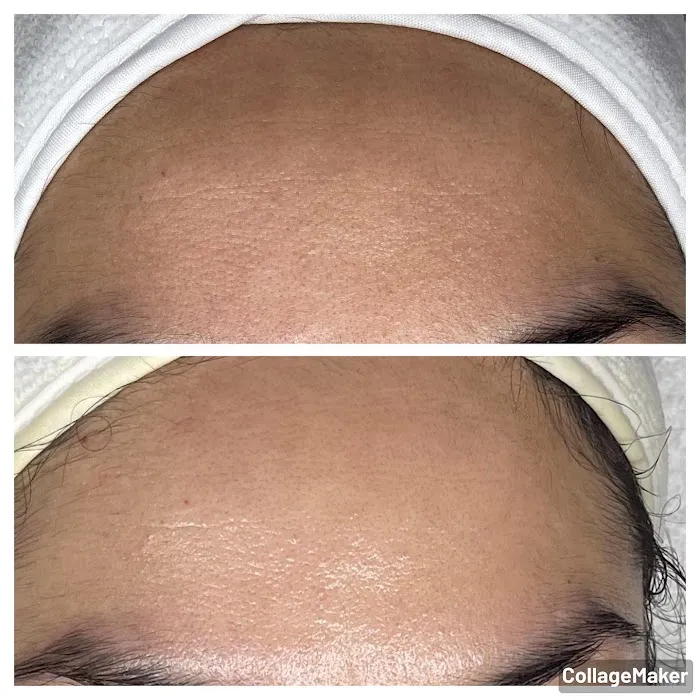 Brightside Aesthetics Picture 10