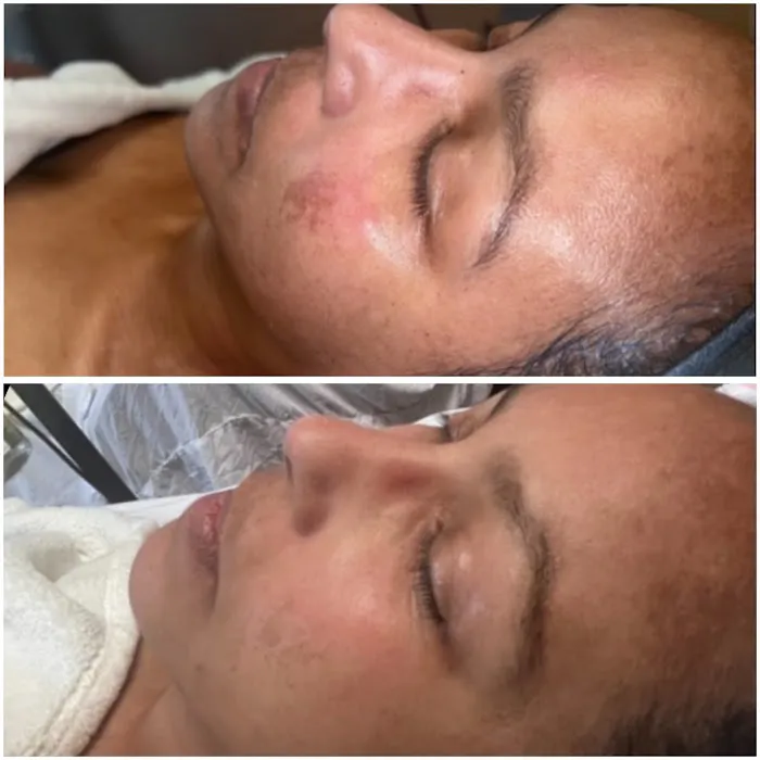 Aura esthetics Picture 5