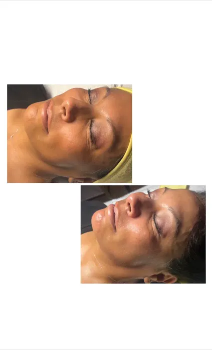 Aura esthetics Picture 2