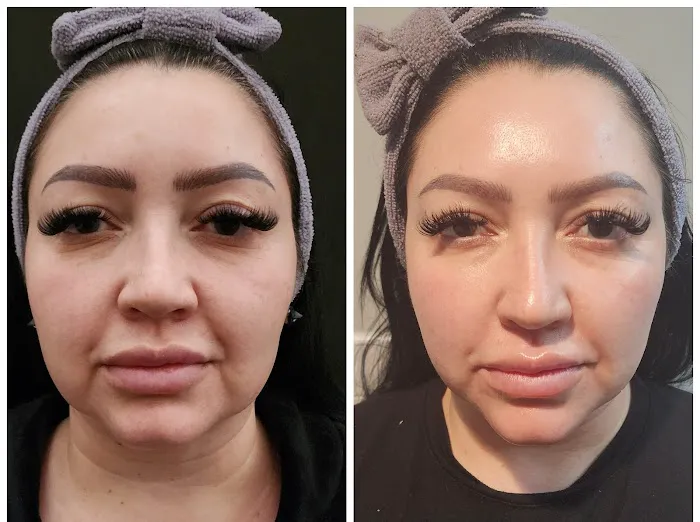 Vanish Laser & Skin Care Picture 3