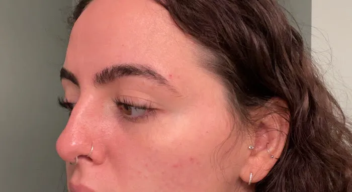 Allure Med Spa Picture 8