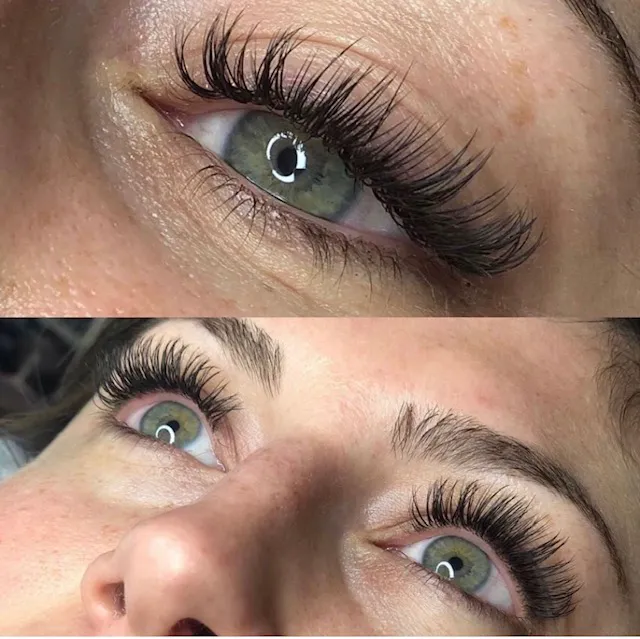 Allure Med Spa Picture 7