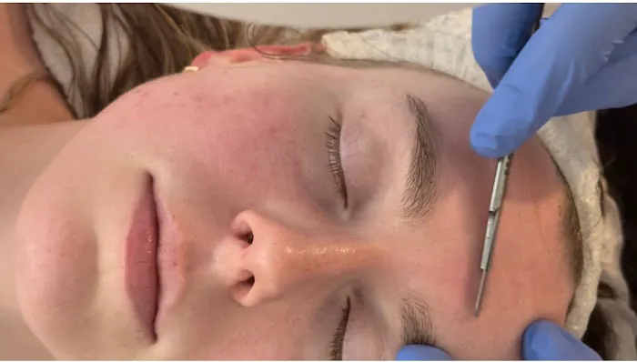 Denver Skin Therapy Picture 2