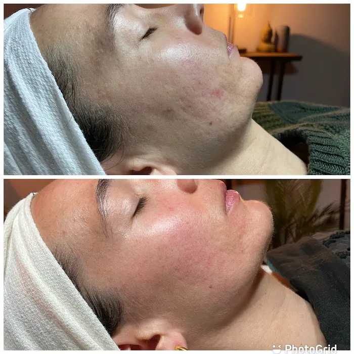 Healing Vibes Esthetics Picture 1