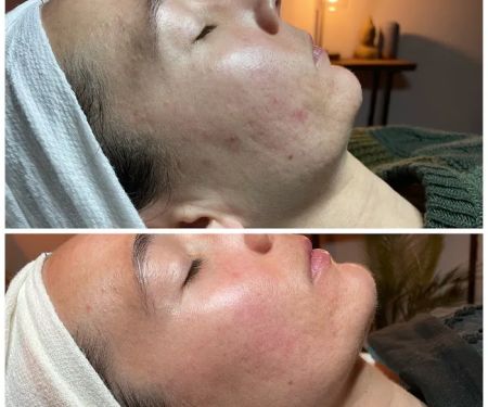 Healing Vibes Esthetics