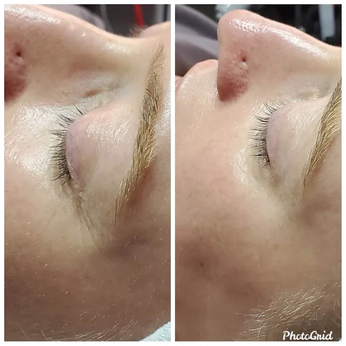 Healing Vibes Esthetics Picture 6