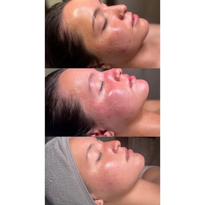 Tommi Marie Aesthetics Picture 6