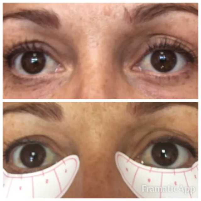 About Faces With Susan D Kirk RN Picture 1