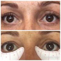 About Faces With Susan D Kirk RN ico