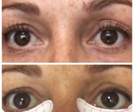 About Faces With Susan D Kirk RN