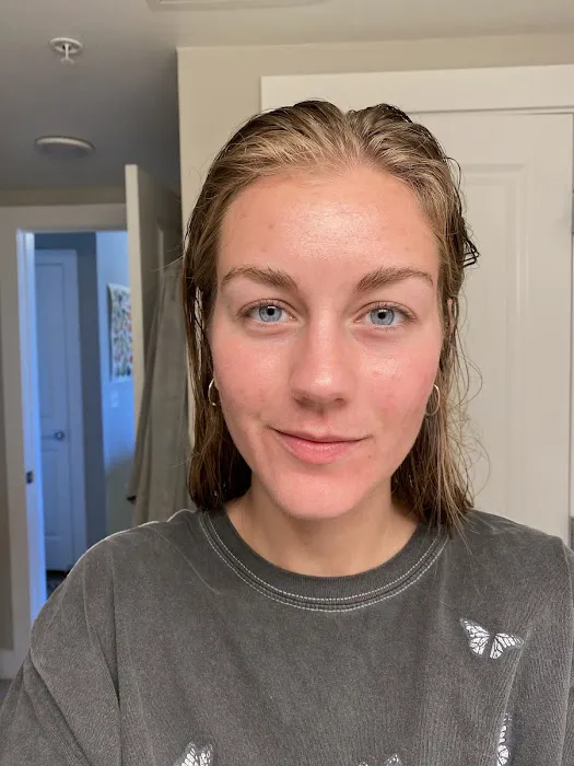 Natural Acne Clinic Picture 4