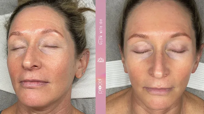 Glow With Ida Picture 10