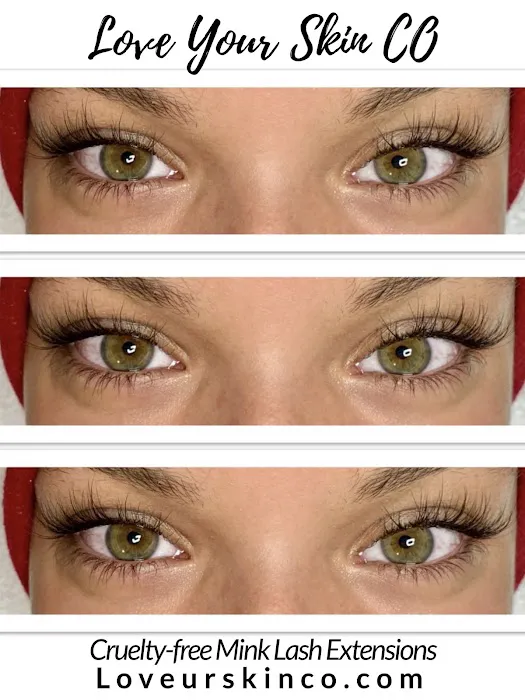 Love Your Skin CO Picture 10