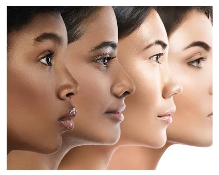 Soft Touch Botox Picture 7