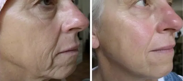 MarLō Skin Care Picture 1