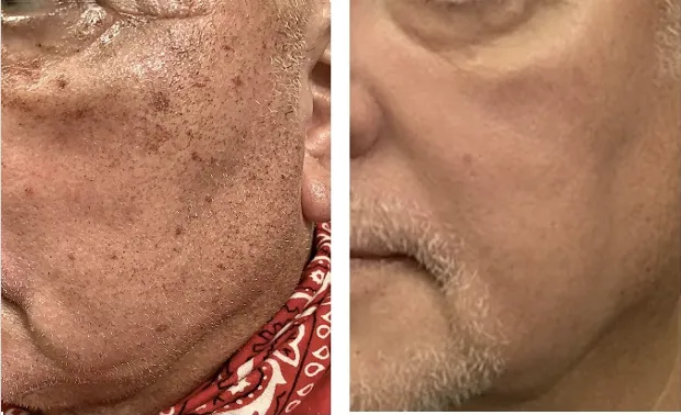 MarLō Skin Care Picture 3