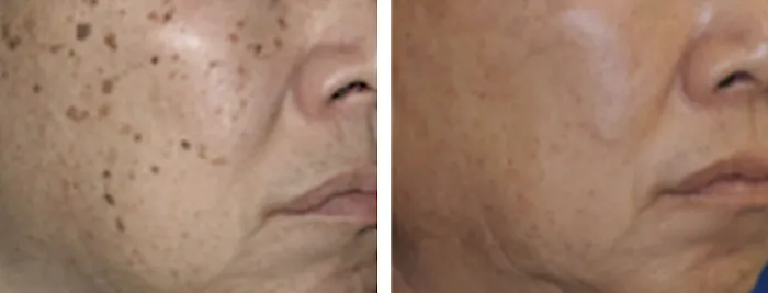 MarLō Skin Care Picture 2