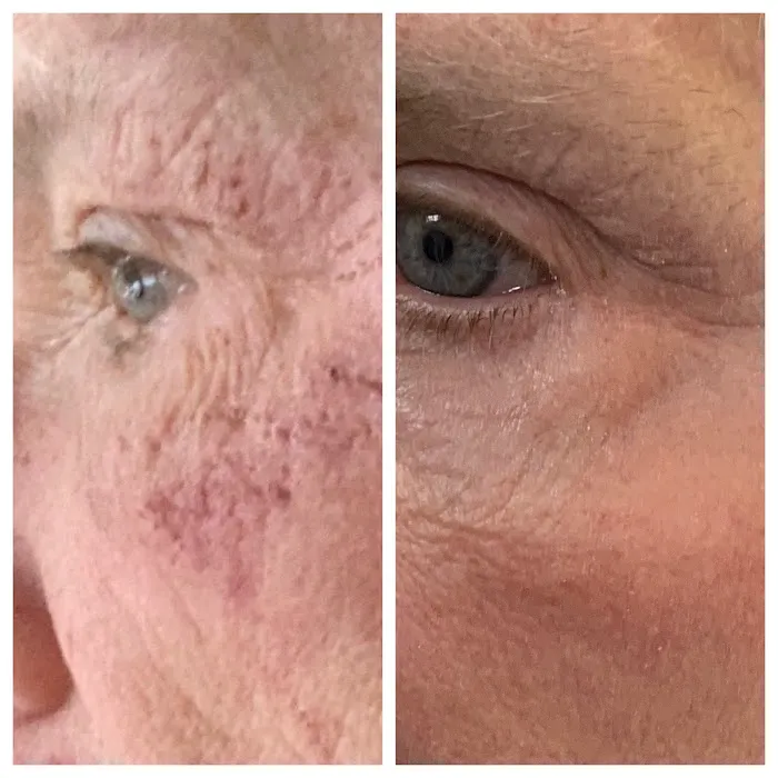 MarLō Skin Care Picture 5