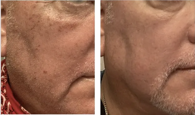 MarLō Skin Care Picture 4