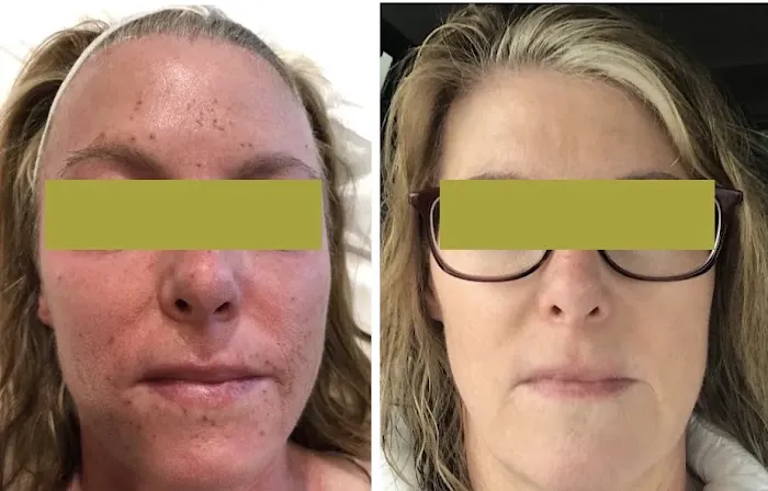 MarLō Skin Care Picture 7