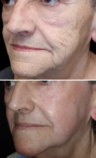 MarLō Skin Care Picture 8