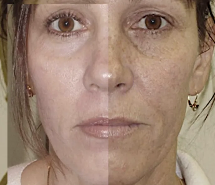 MarLō Skin Care Picture 9