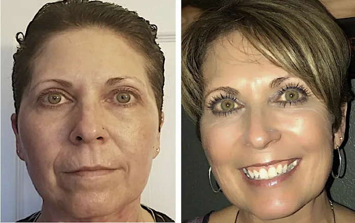 MarLō Skin Care Picture 10