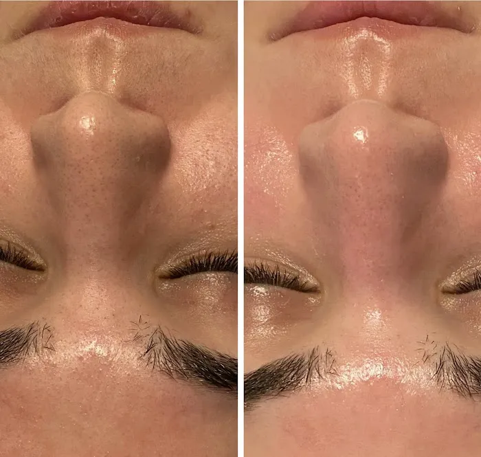 Face to Face Skincare Picture 1