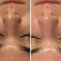 Face to Face Skincare ico