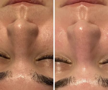 Face to Face Skincare