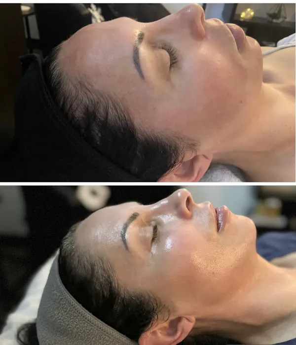 Face to Face Skincare Picture 6