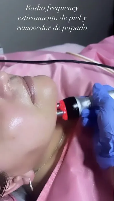 Gen Skin & Body Picture 2