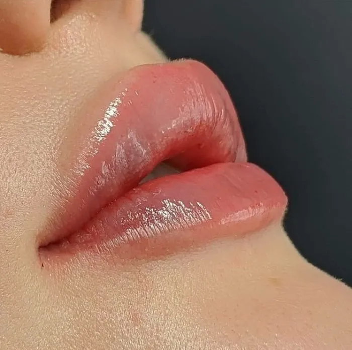 Safi Miran Denver Rejuvenation Center Picture 9